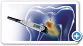 DIAGNOdent_pen